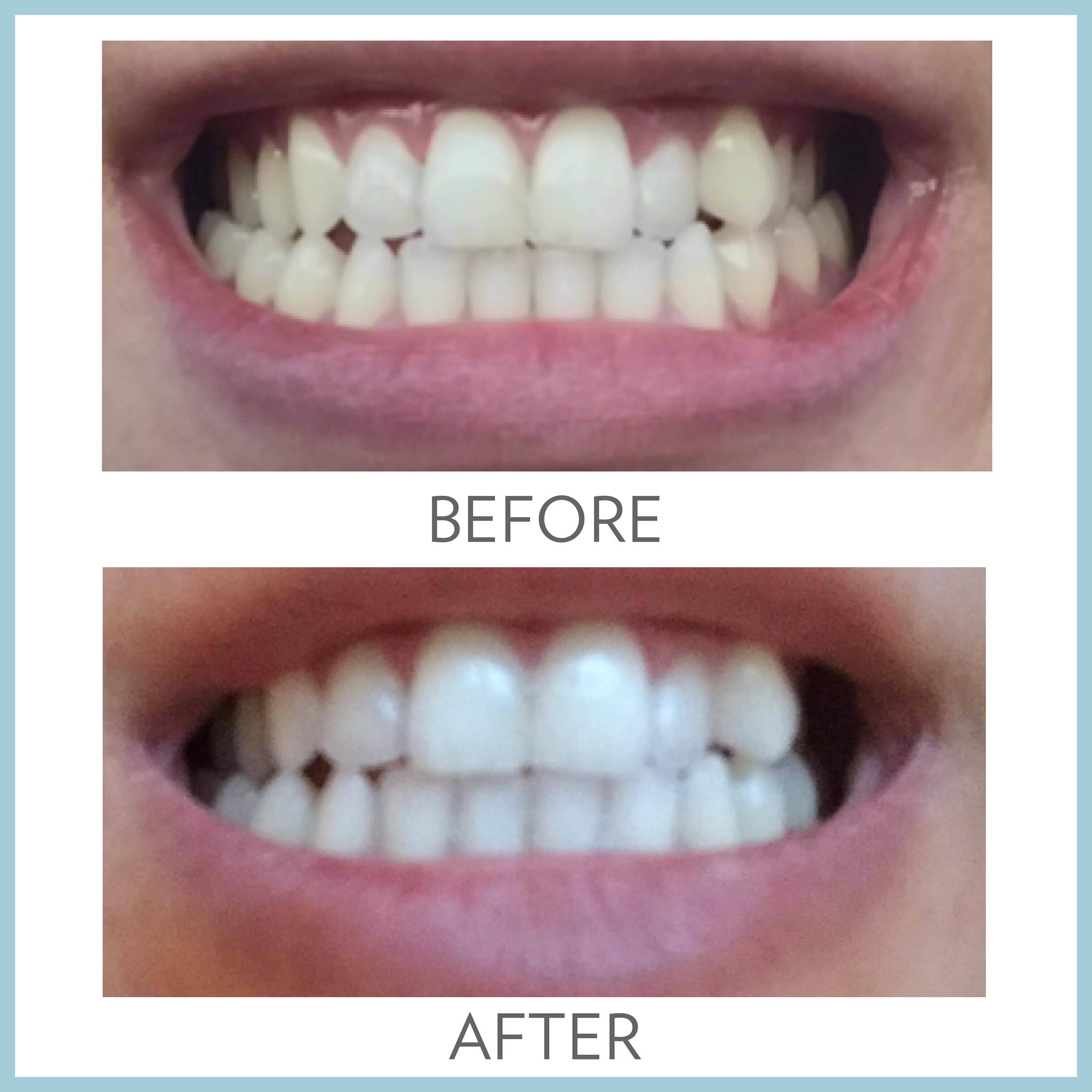 AP24 Whitening Fluoride Toothpaste by Nu Skin for stain removal and oral care Solution