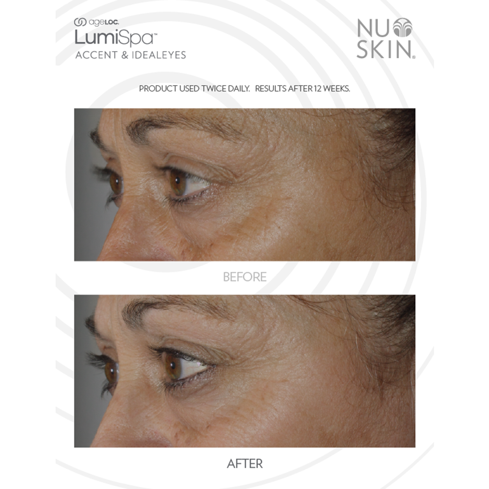 ageLOC LumiSpa IdealEyes Activating Eye