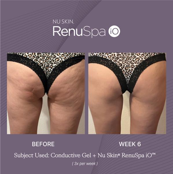 ageLOC RenuSpa iO | Nu Skin | NuSkin