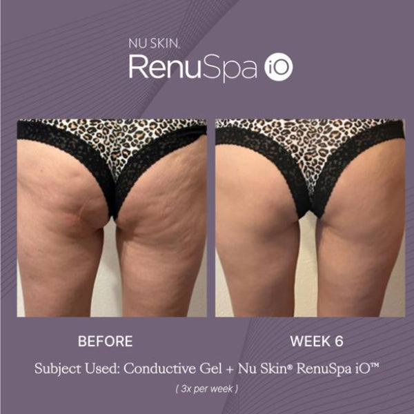 Nu Skin RenuSpa iO – Adaptive Microcurrent Body Device & Wellness System