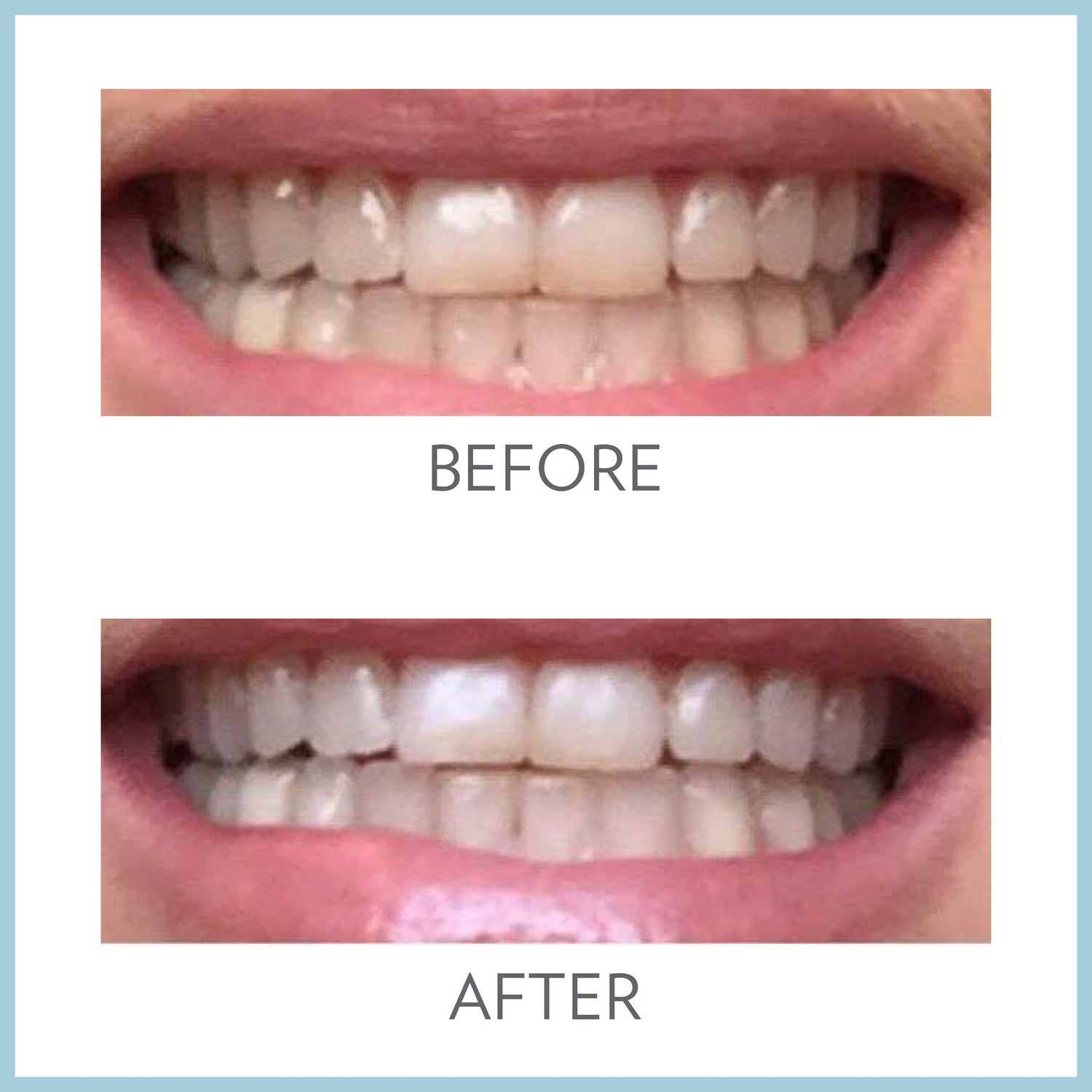 AP24 Whitening Fluoride Toothpaste by Nu Skin for stain removal and oral care Solution
