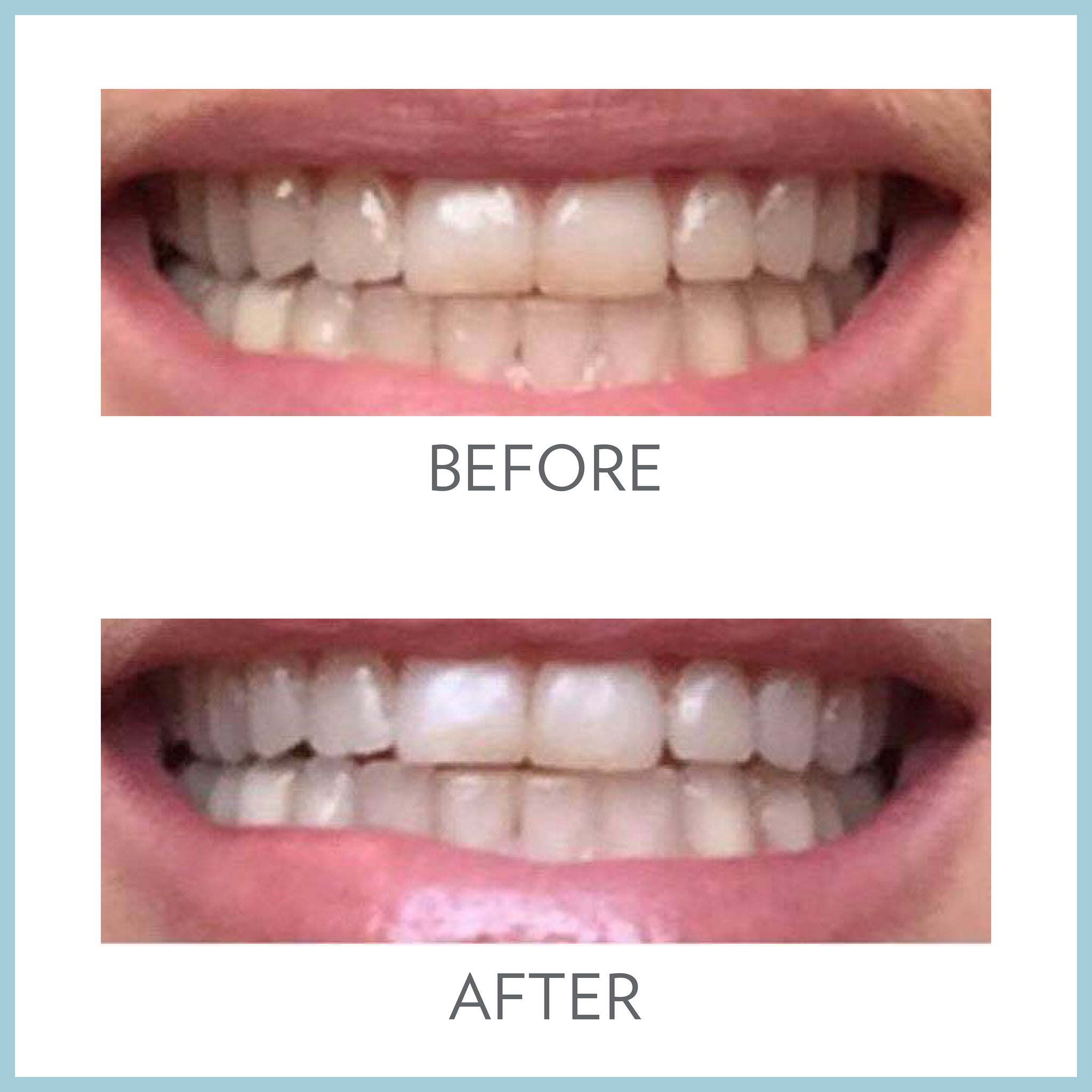 AP24 Whitening Fluoride Toothpaste by Nu Skin for stain removal and oral care Solution