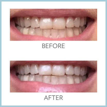 AP24 Whitening Fluoride Toothpaste by Nu Skin for stain removal and oral care Solution