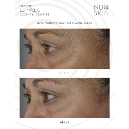 ageLOC LumiSpa IdealEyes Activating Eye 